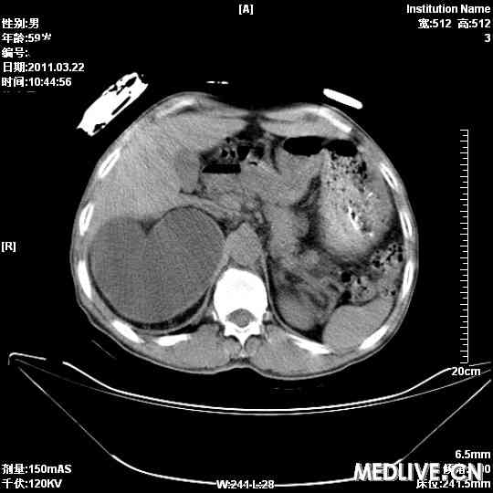 20110718033257213.jpg