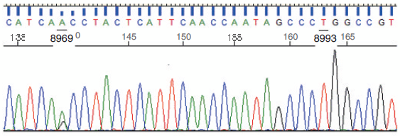 患者外周血单核细胞线粒体dna(mtdna)8969位点发生g→a突变