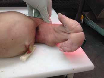 并腿畸形一例.