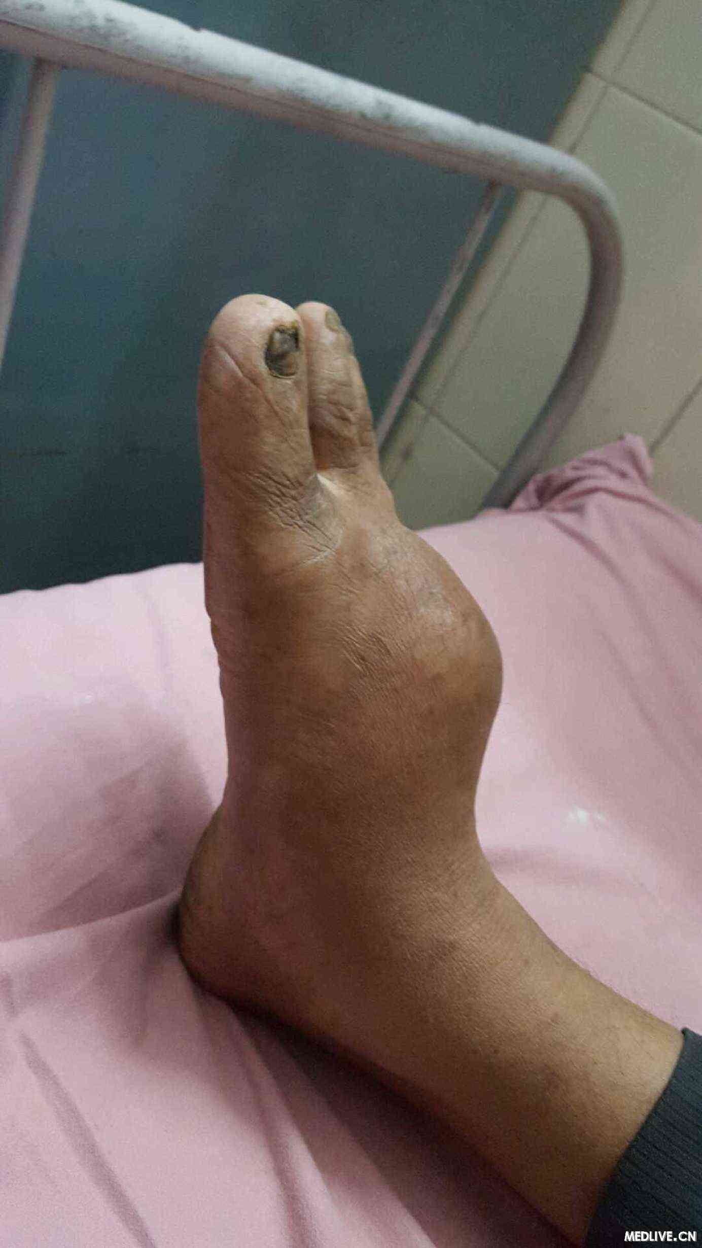 应该怎样治疗?