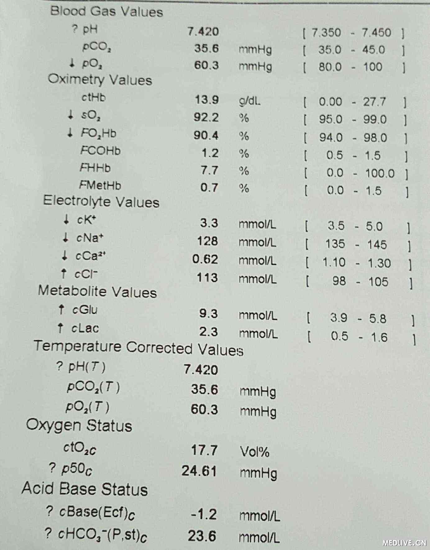 昏睡简谱_美女昏睡(3)