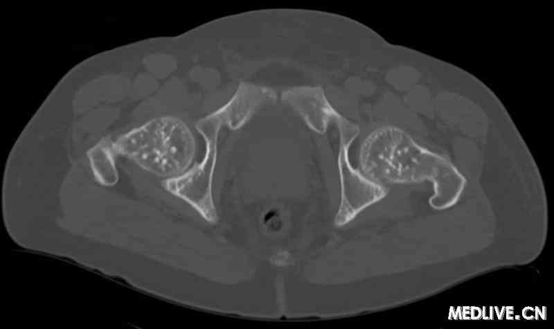 男生肚子疼痛是什么原因 201605311713248337.jpg