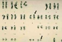 血液科病例_血液科