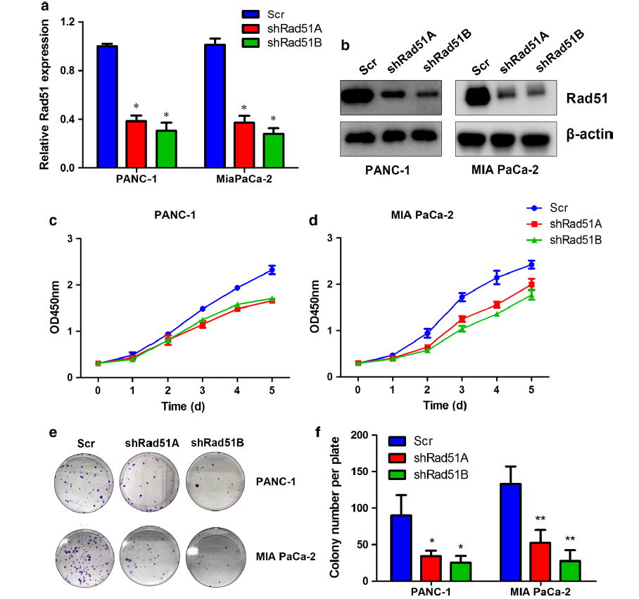 rad51调节胰腺癌细胞增殖并有望成为预后标记物