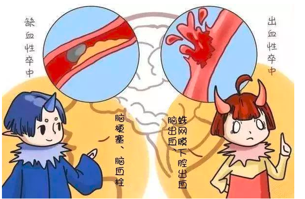 我的别称有"中风","脑血管意外","脑血管病".