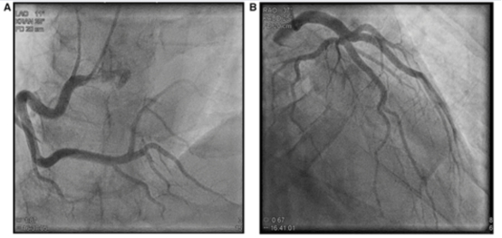 冠状动脉造影图像:右冠状动脉(a)和左冠状动脉(b)