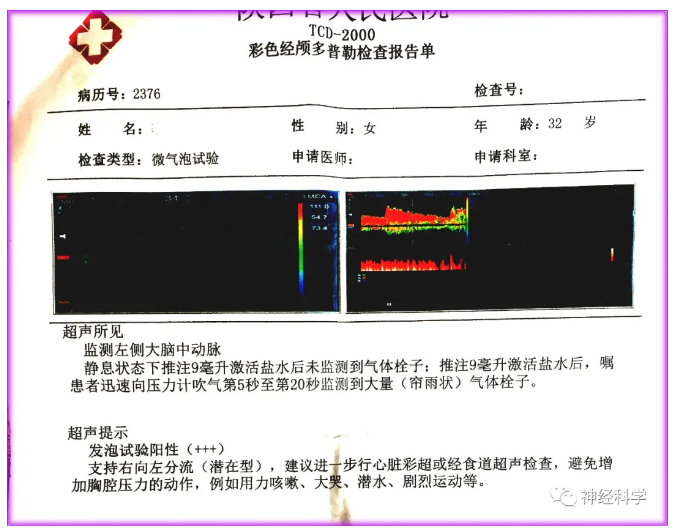 于是,接下来一切发现都顺理成章——我们先给她做了经颅多普勒超声